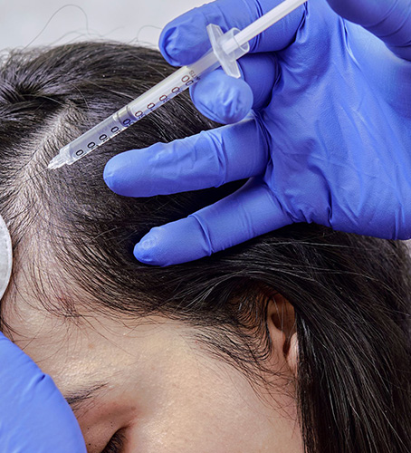 GFC Treatment for hair