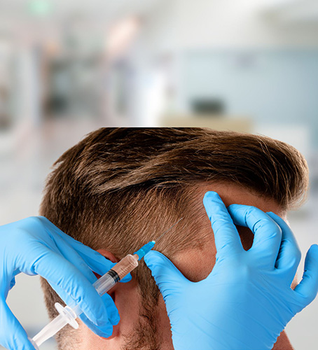 PRP Treatment for hair