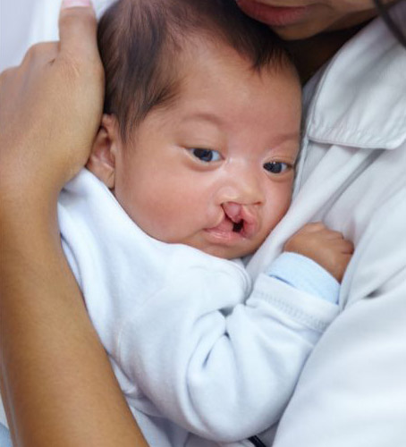 Correction of defects occured by birth