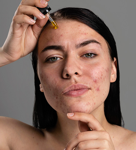 Skin Pigmentation Treatment