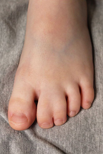 Correction of birth defects
