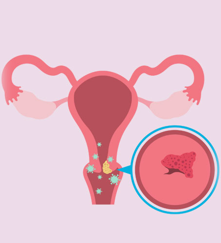 hymenoplasty procedure