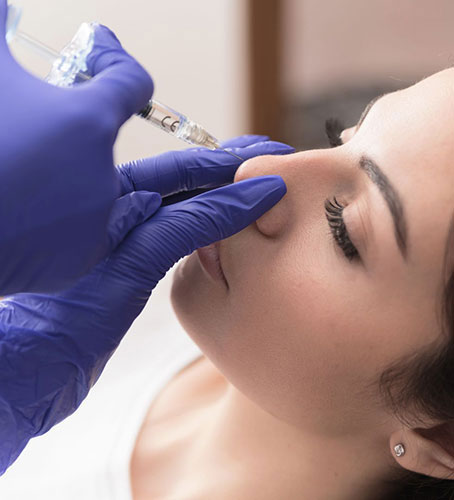 Rhinoplasty Procedures