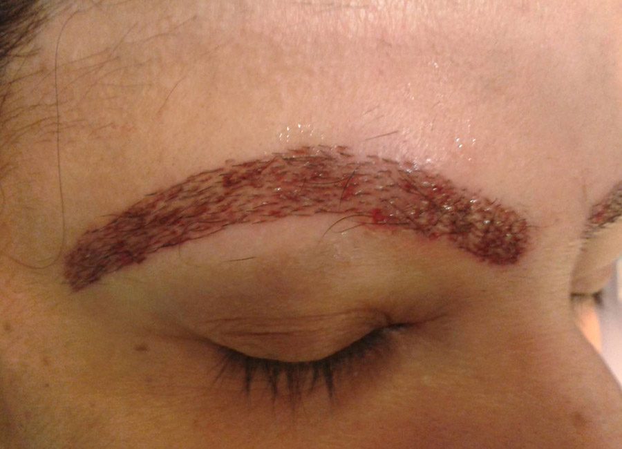 Hair Treatment Eye Bro