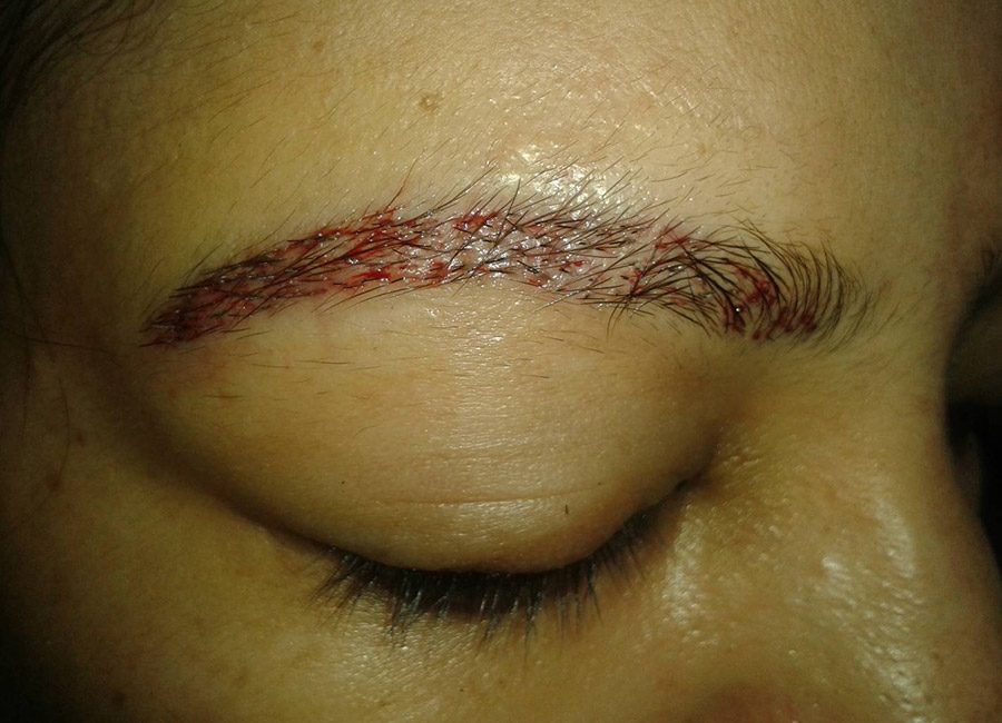 Hair Treatment Eye Bro